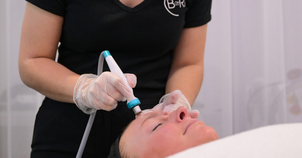 SKIN ELIXIR FACIAL MICRODERMABRASION by Beauty on Rose Essendon Melbourne